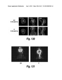 CNS DELIVERY OF THERAPEUTIC AGENTS diagram and image