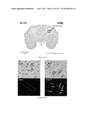 CNS DELIVERY OF THERAPEUTIC AGENTS diagram and image