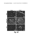 CNS DELIVERY OF THERAPEUTIC AGENTS diagram and image