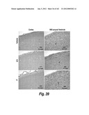 CNS DELIVERY OF THERAPEUTIC AGENTS diagram and image