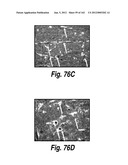 CNS DELIVERY OF THERAPEUTIC AGENTS diagram and image