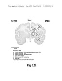 CNS DELIVERY OF THERAPEUTIC AGENTS diagram and image