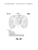 CNS DELIVERY OF THERAPEUTIC AGENTS diagram and image