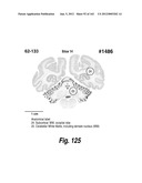 CNS DELIVERY OF THERAPEUTIC AGENTS diagram and image