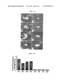 PHARMACEUTICAL COMPOSITION CONTAINING ARAZYME FOR THE PREVENTION OF LIVER     DYSFUNCTION diagram and image