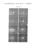 PHARMACEUTICAL COMPOSITION CONTAINING ARAZYME FOR THE PREVENTION OF LIVER     DYSFUNCTION diagram and image