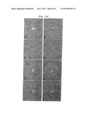 PHARMACEUTICAL COMPOSITION CONTAINING ARAZYME FOR THE PREVENTION OF LIVER     DYSFUNCTION diagram and image