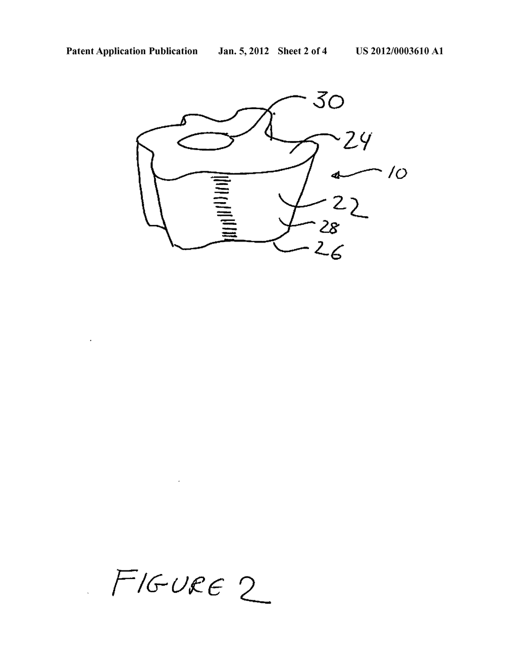 APPARATUS AND DIGITAL METHODOLOGY FOR PREPARATION OF A DENTAL IMPLANT     SURGICAL SITE FOR THE PROMOTION OF A DESIRED EMERGENT SULCUS - diagram, schematic, and image 03