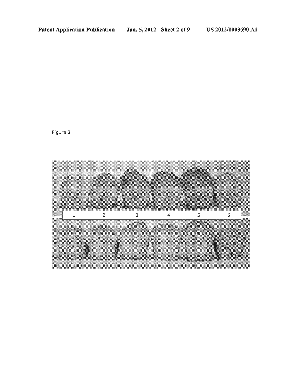 ENZYMATIC GENERATION OF FUNCTIONAL LIPIDS FROM CEREALS OR CEREAL     BI-STREAMS - diagram, schematic, and image 03