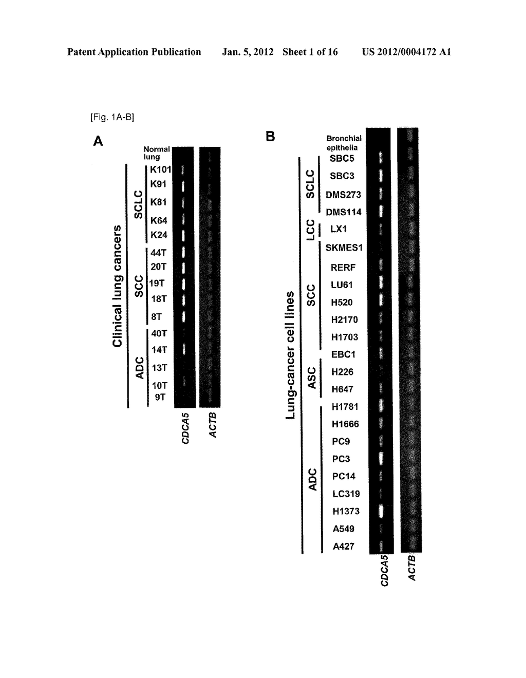 SCREENING METHOD OF ANTI-LUNG OR ESOPHAGEAL CANCER COMPOUNDS - diagram, schematic, and image 02