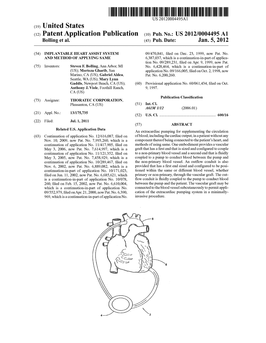 IMPLANTABLE HEART ASSIST SYSTEM AND METHOD OF APPLYING SAME - diagram, schematic, and image 01