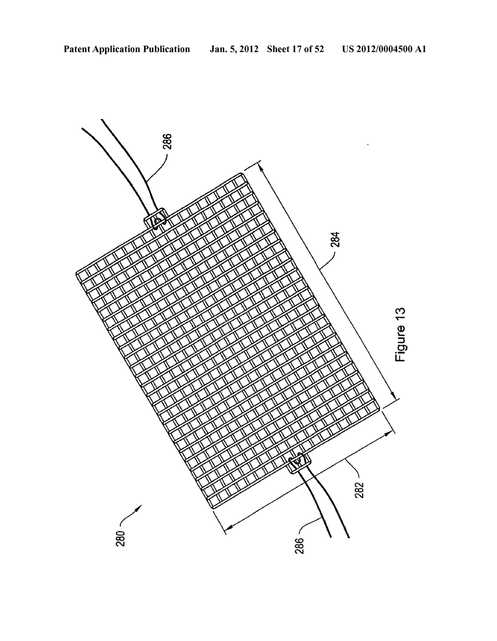 SYSTEMS, DEVICES, AND METHODS FOR SUB-URETHRAL SUPPORT - diagram, schematic, and image 18