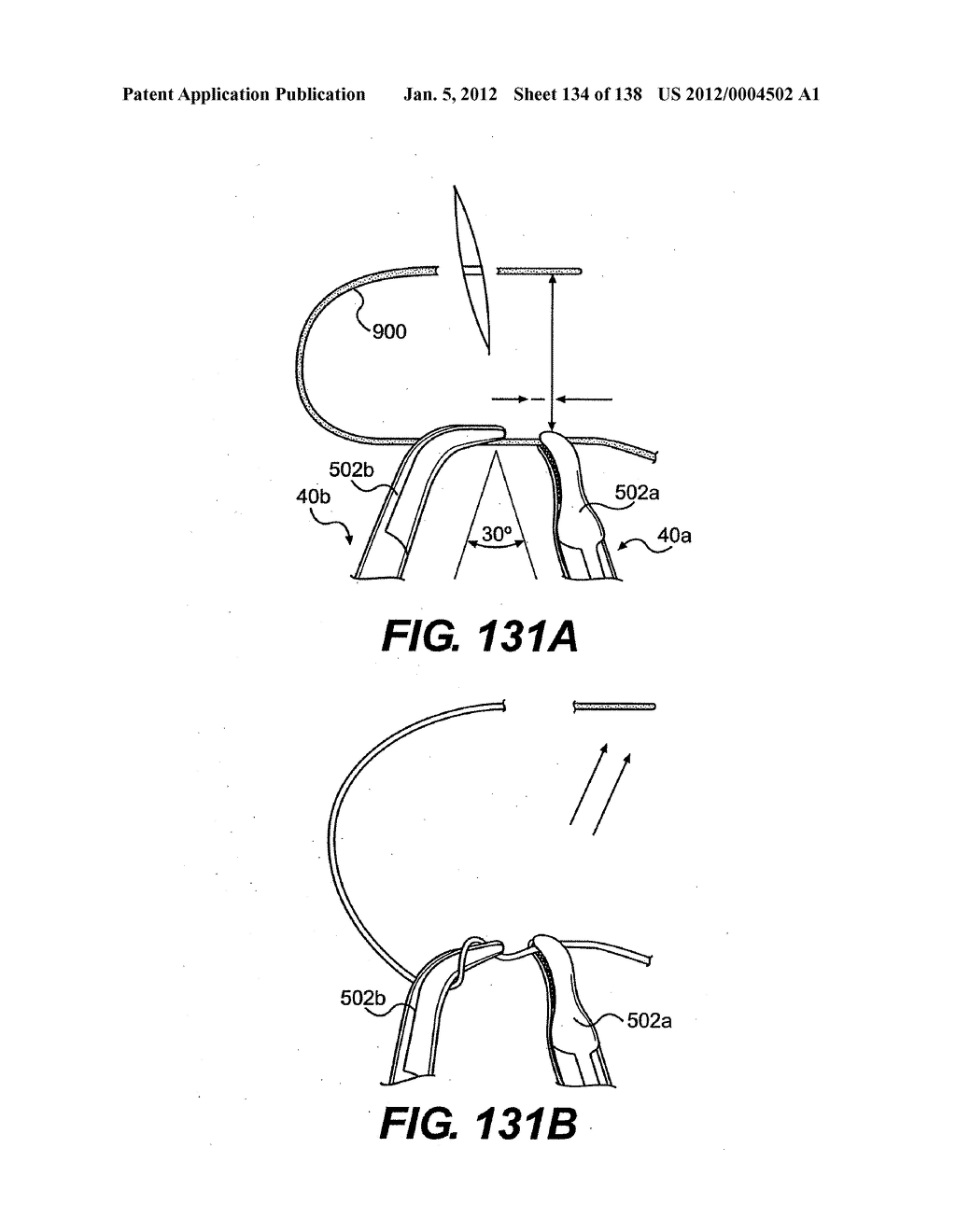 DIRECT DRIVE ENDOSCOPY SYSTEMS AND METHODS - diagram, schematic, and image 135