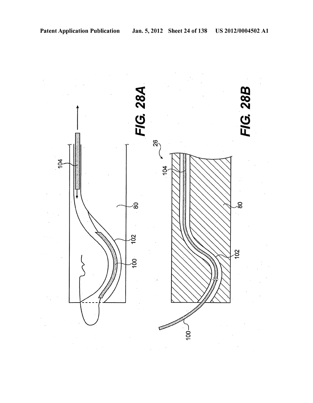 DIRECT DRIVE ENDOSCOPY SYSTEMS AND METHODS - diagram, schematic, and image 25