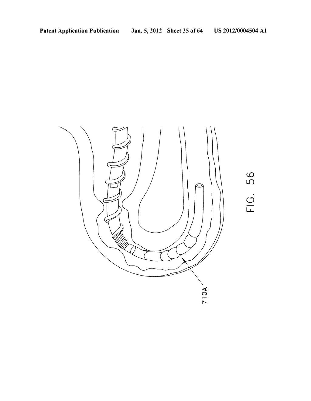 ROTATE-TO-ADVANCE CATHETERIZATION SYSTEM - diagram, schematic, and image 36