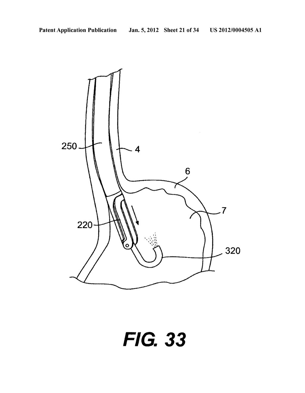 DEVICES AND METHODS FOR TISSUE INVAGINATION - diagram, schematic, and image 22