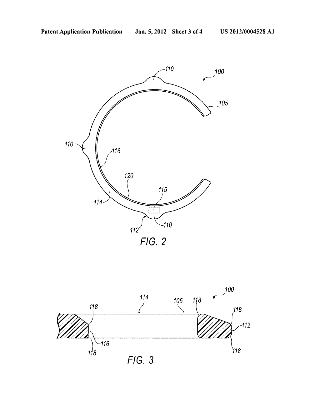 Implantable Remote Monitoring Sensor - diagram, schematic, and image 04