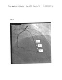 CO-USE OF ENDOLUMINAL DATA AND EXTRALUMINAL IMAGING diagram and image