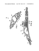 SYSTEM INCLUDING AN IMPLANTABLE MEDICAL DEVICE AND ELECTRONIC VALVE     INDICATOR AND LOCATOR DEVICE diagram and image