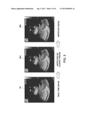 METHOD AND SYSTEM FOR ULTRASOUND DATA PROCESSING diagram and image