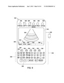 METHOD AND SYSTEM FOR ULTRASOUND DATA PROCESSING diagram and image