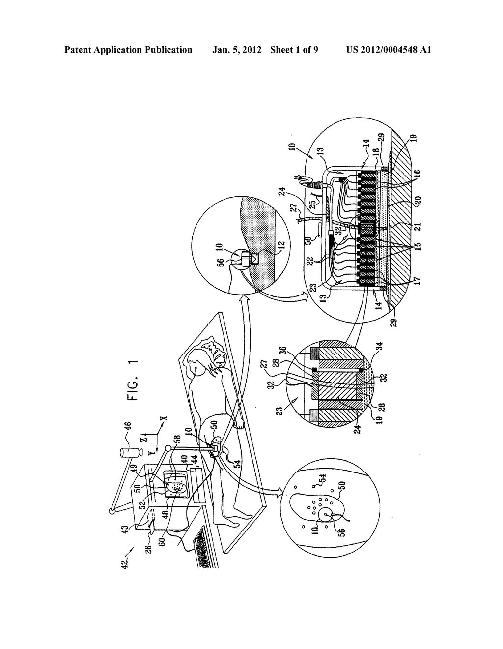 NON-THERMAL ACOUSTIC TISSUE MODIFICATION - diagram, schematic, and image 02