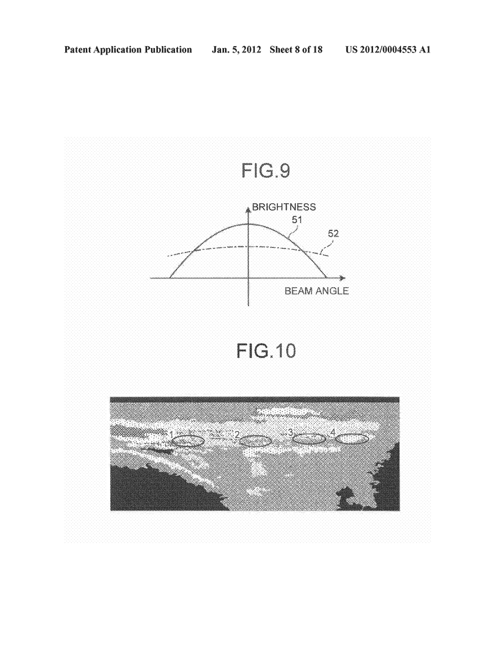 ULTRASONIC DIAGNOSTIC APPARATUS AND STORAGE MEDIUM - diagram, schematic, and image 09