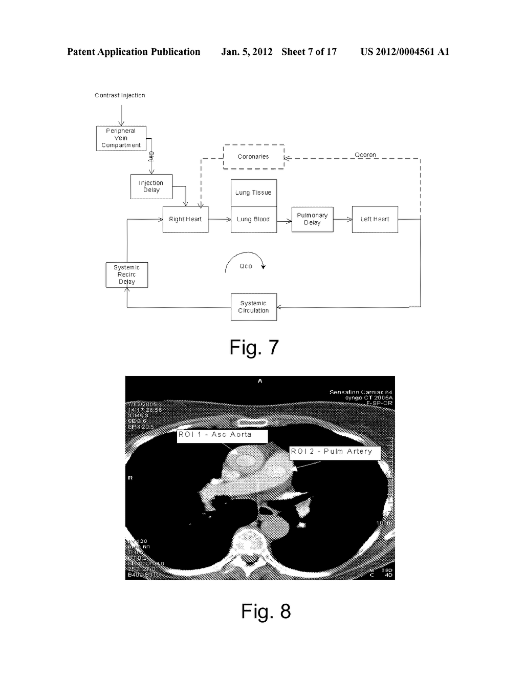 SYSTEMS AND METHODS OF DETERMINING PATIENT PHYSIOLOGICAL PARAMETERS FROM     AN IMAGING PROCEDURE - diagram, schematic, and image 08