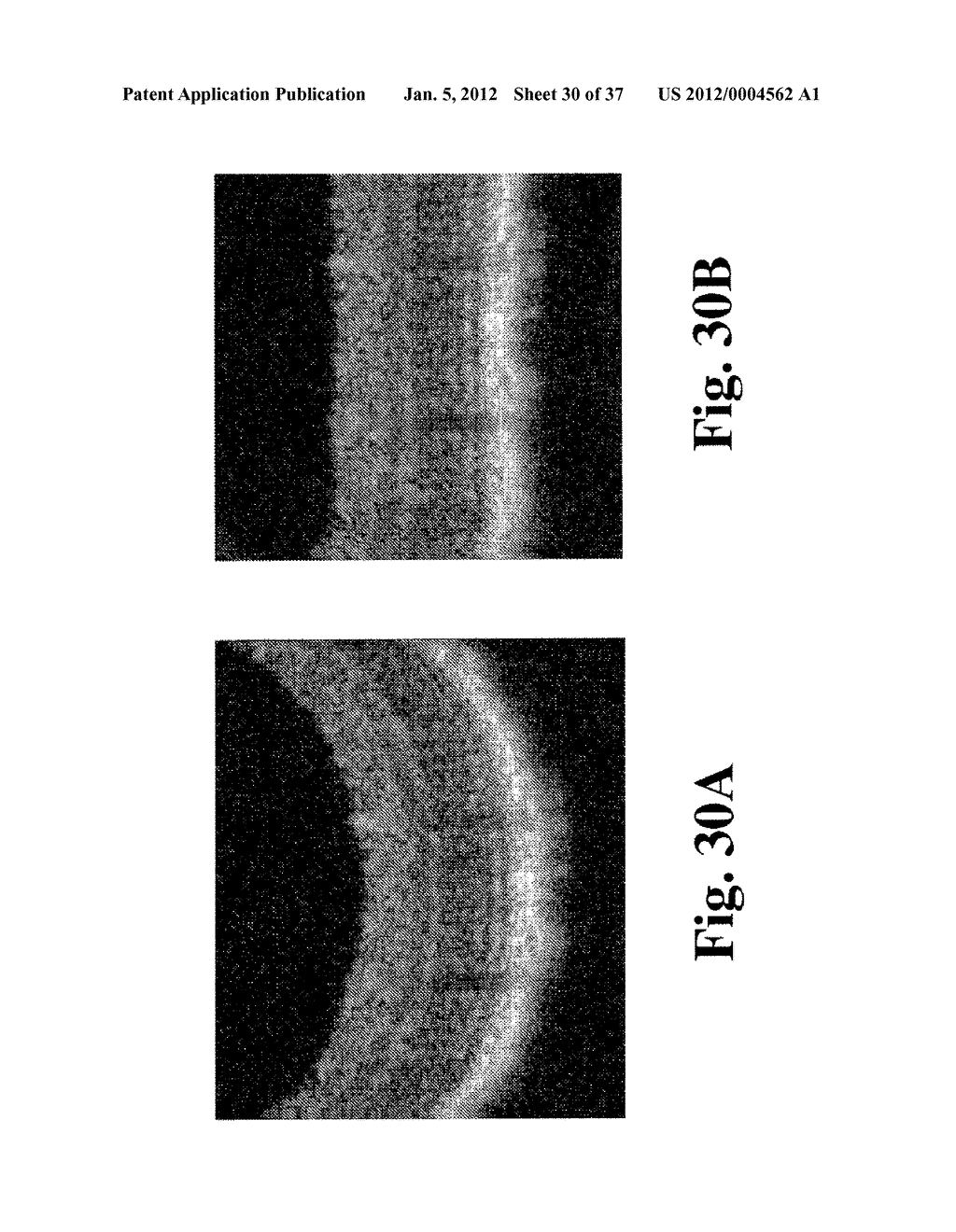 DYNAMIC MOTION CONTRAST AND TRANSVERSE FLOW ESTIMATION USING OPTICAL     COHERENCE TOMOGRAPHY - diagram, schematic, and image 31