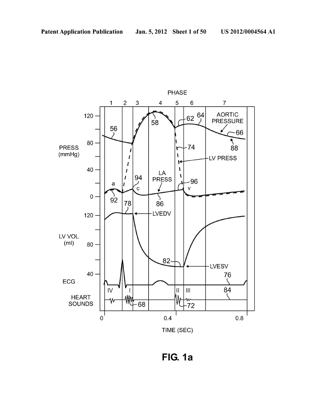 DEVICES AND METHOD FOR ACCELEROMETER-BASED CHARACTERIZATION OF CARDIAC     SYNCHRONY AND DYSSYNCHRONY - diagram, schematic, and image 02