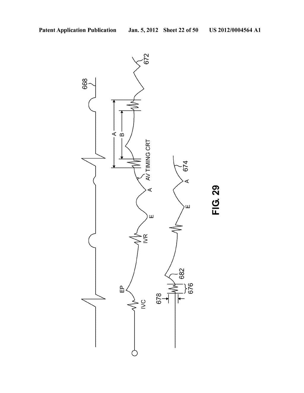 DEVICES AND METHOD FOR ACCELEROMETER-BASED CHARACTERIZATION OF CARDIAC     SYNCHRONY AND DYSSYNCHRONY - diagram, schematic, and image 23