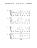 Method of Determining Depth of Chest Compressions During CPR diagram and image