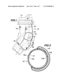 Elbow Brace diagram and image