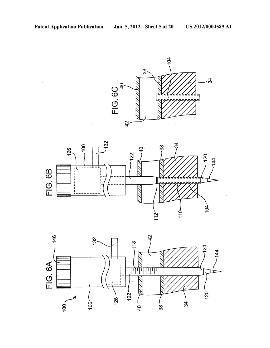 DELIVERING A CONDUIT INTO A HEART WALL TO PLACE A CORONARY VESSEL IN     COMMUNICATION WITH A HEART CHAMBER AND REMOVING TISSUE FROM THE VESSEL OR     HEART WALL TO FACILITATE SUCH COMMUNICATION - diagram, schematic, and image 06