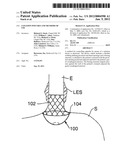 SATIATION POUCHES AND METHODS OF USE diagram and image