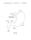 SATIATION POUCHES AND METHODS OF USE diagram and image