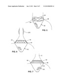 SATIATION POUCHES AND METHODS OF USE diagram and image