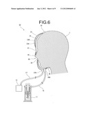 GAS MIST PRESSURE BATH DEVICE diagram and image