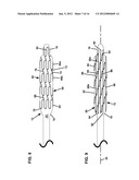 CATHETER ASSEMBLY diagram and image