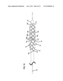 CATHETER ASSEMBLY diagram and image