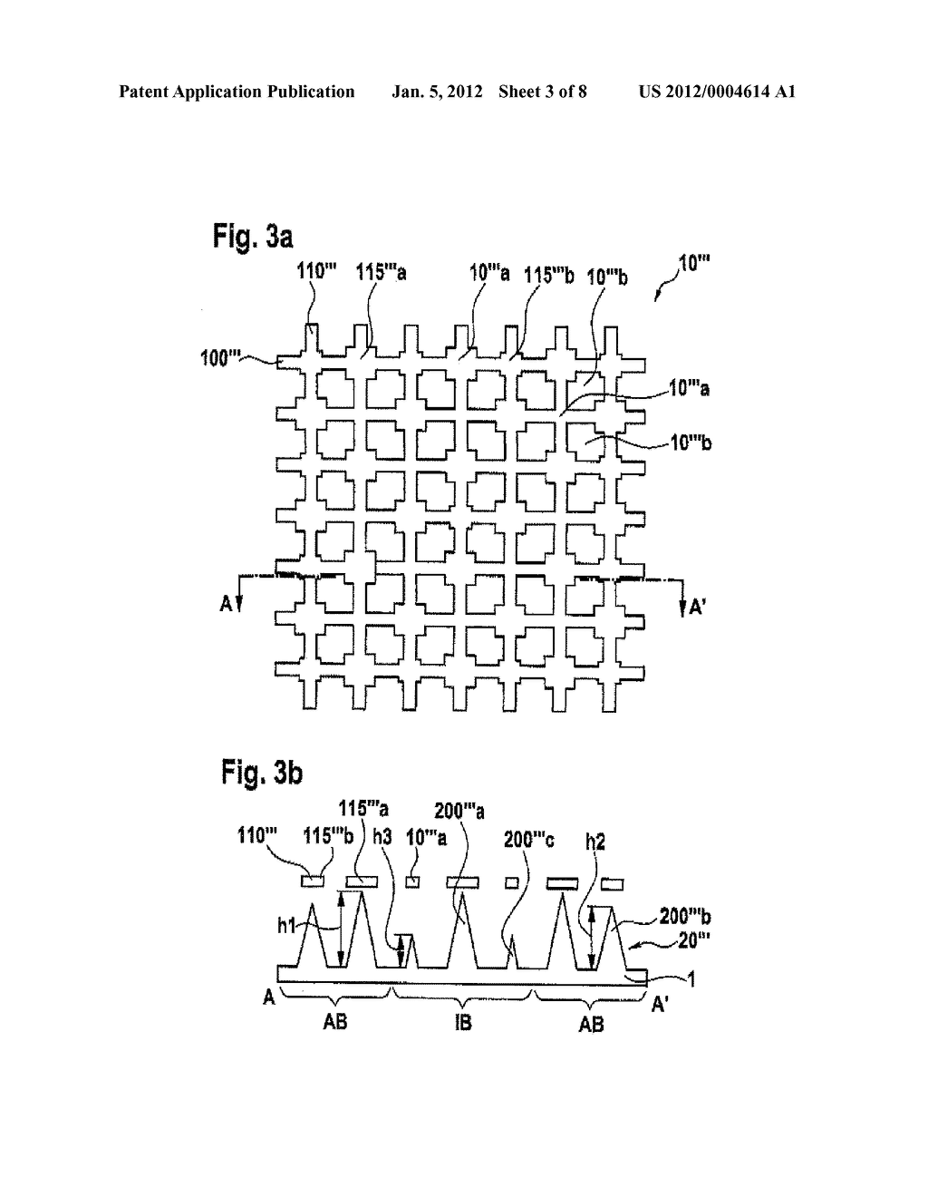 Production Process for a Microneedle Arrangement and Corresponding     Microneedle Arrangement and Use - diagram, schematic, and image 04