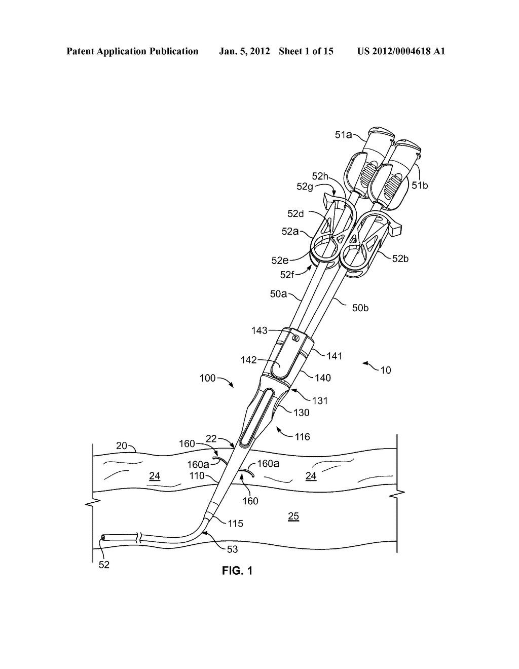 Anchoring a Medical Instrument - diagram, schematic, and image 02