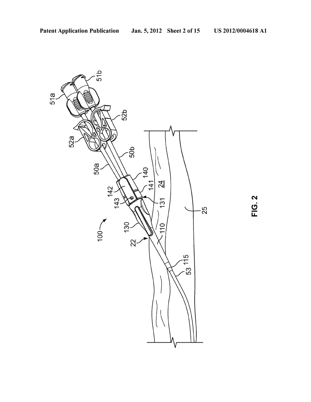 Anchoring a Medical Instrument - diagram, schematic, and image 03