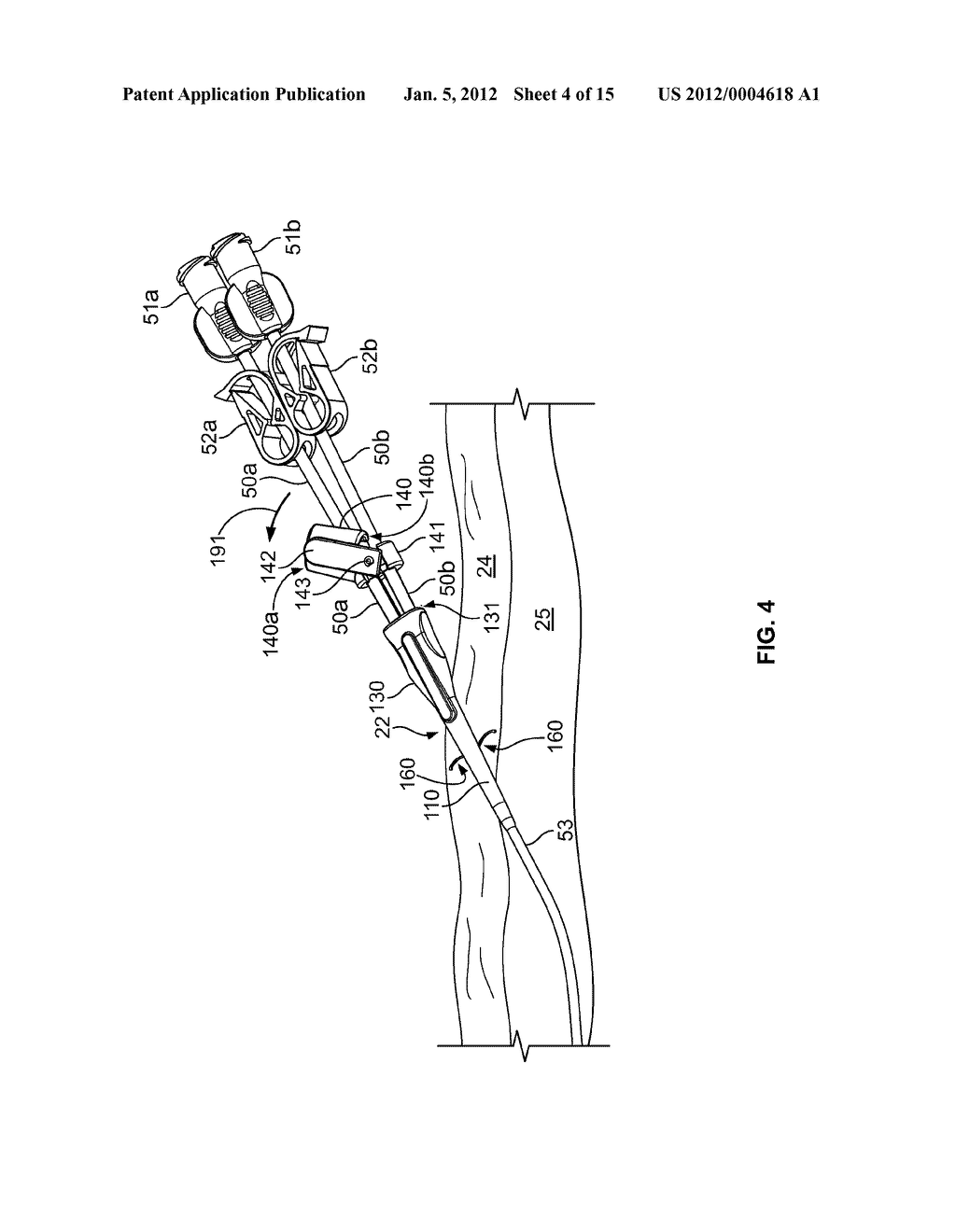 Anchoring a Medical Instrument - diagram, schematic, and image 05