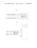 SURGICAL INSTRUMENT diagram and image