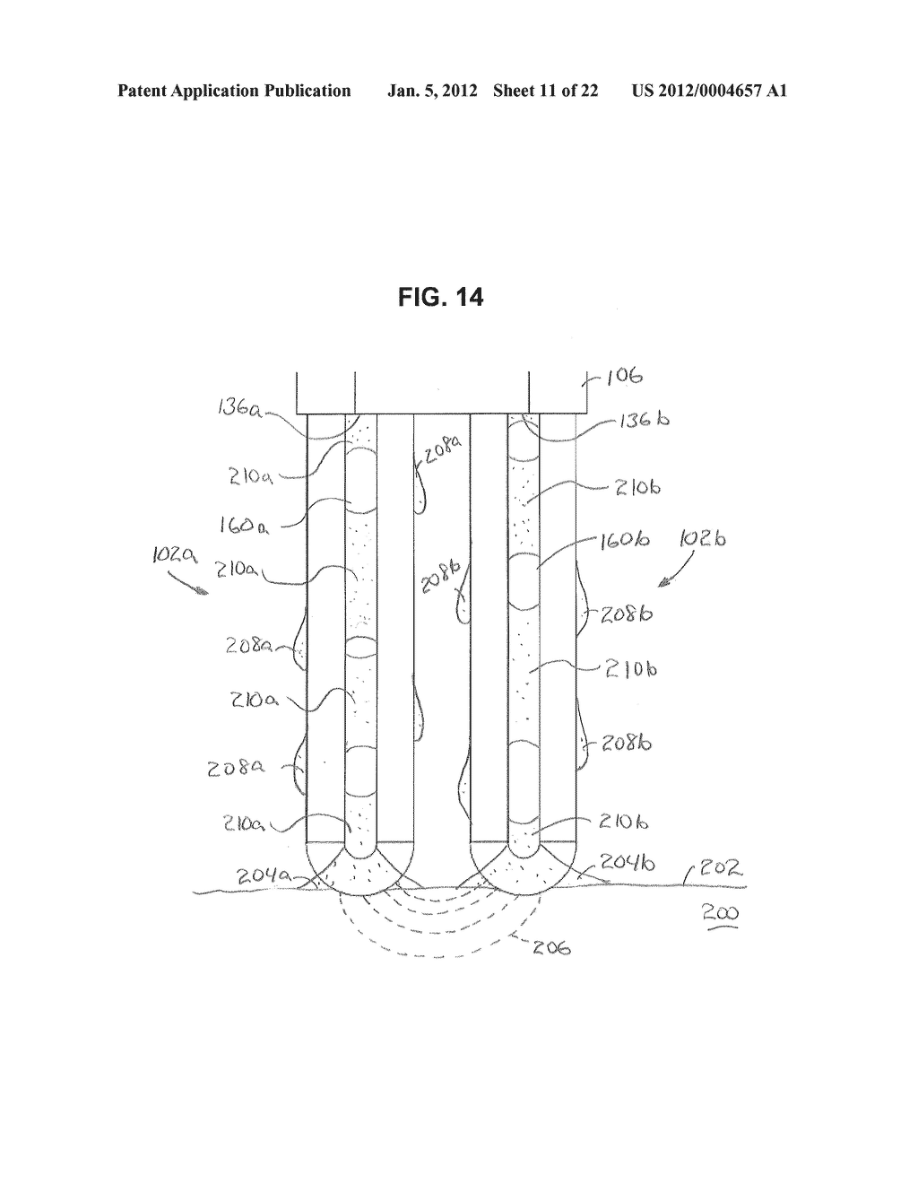 Electrosurgical Devices with Wire Electrode And Methods of Use Thereof - diagram, schematic, and image 12