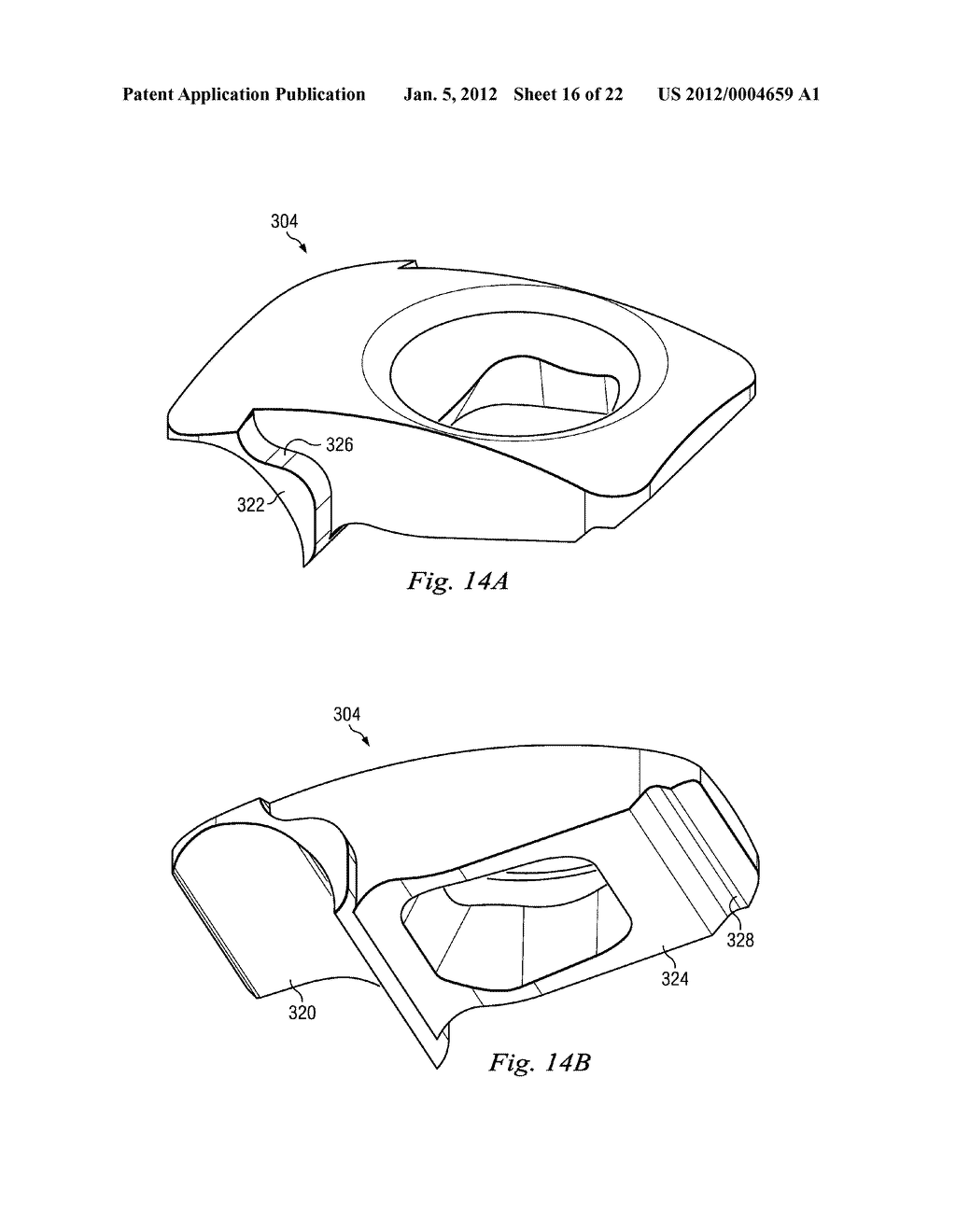 Multi-Locking External Fixation Clamp - diagram, schematic, and image 17