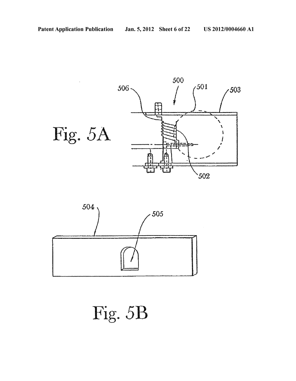 Multi-component cortical bone assembled implant - diagram, schematic, and image 07