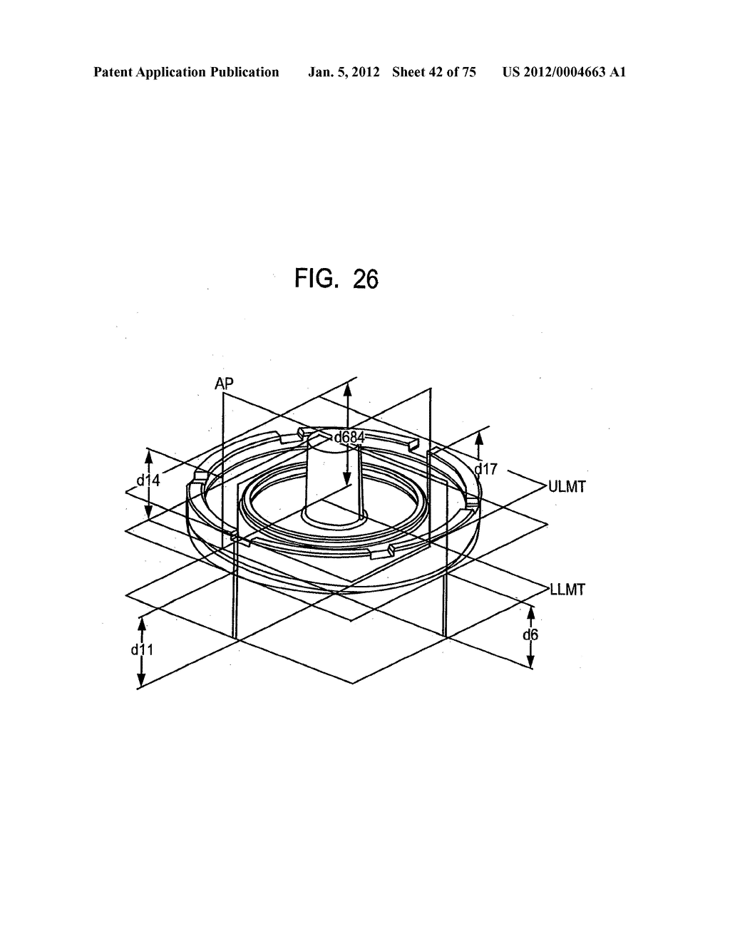 System and Method for Joint Resurface Repair - diagram, schematic, and image 43