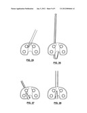 MEDICAL IMPLANT EXTRACTION DEVICE diagram and image